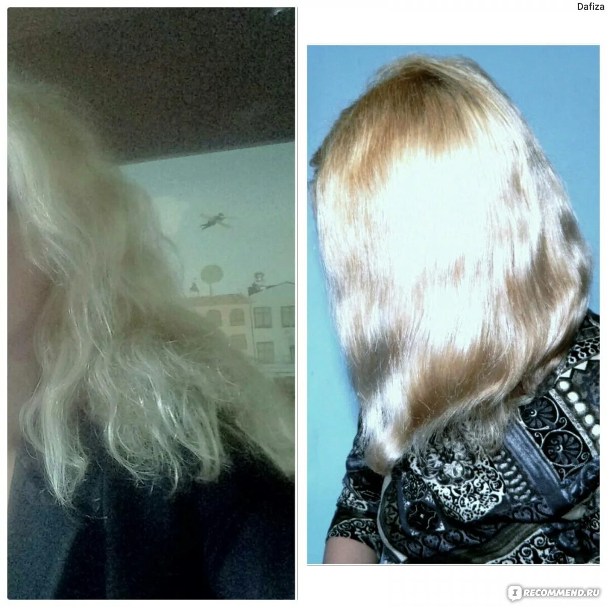 Никотиновую кислоту нужно смывать