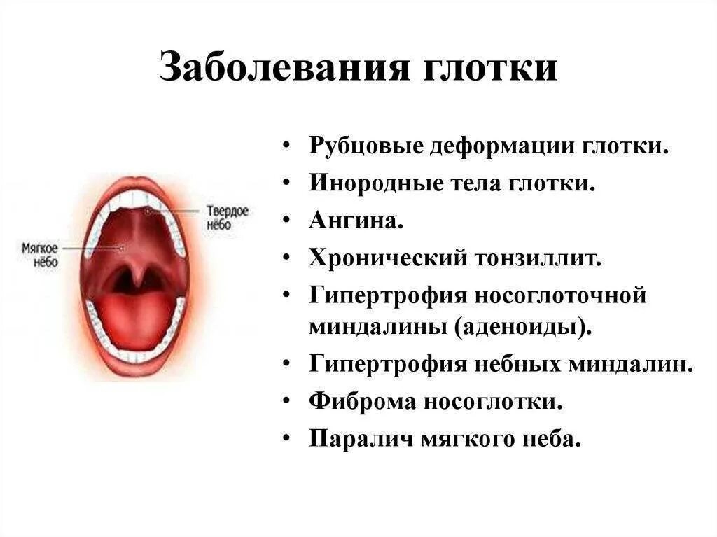 Ощущение сухости в горле