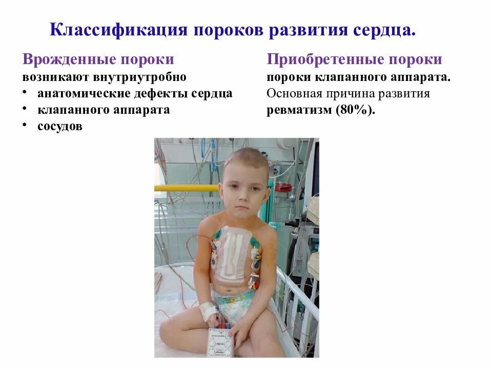 Тест врожденные пороки развития. Врожденные пороки развития. приобретенные пороки развития. дети с множественными пороками развития.