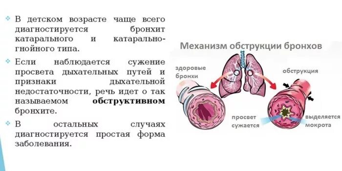 Месяц болею бронхитом. Бронхит с синдромом бронхиальной обструкции у детей. При обструктивном бронхите у детей развивается дыхание. Механизм обструкции бронхов у детей. Острый бронхообструктивный бронхит.