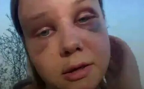 Избил отца девушки