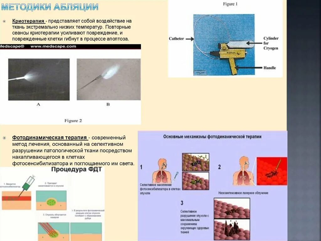 Абляция пищевода. Метод лазерной абляции. Лазерная абляция схема установки. Микроволновая абляция. Абляция это физика.