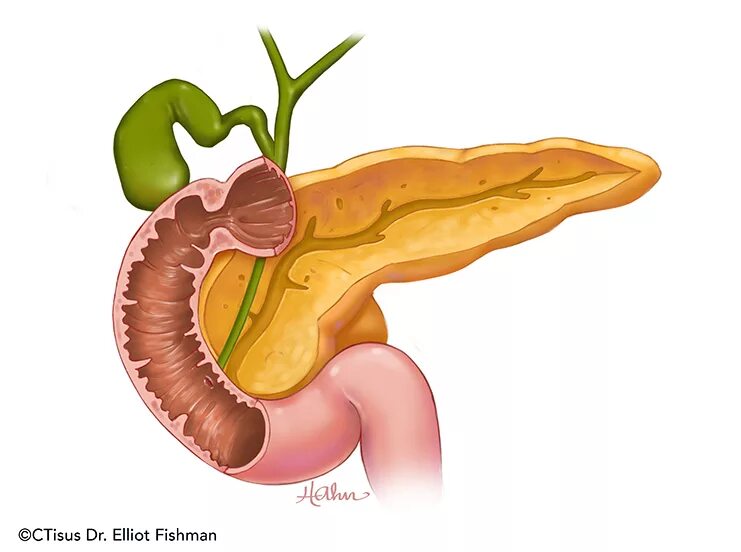 Крупный желчный пузырь. Поджелудочная железа pancreas. Рисунок поджелудочной железы человека. Веселая поджелудочная железа.