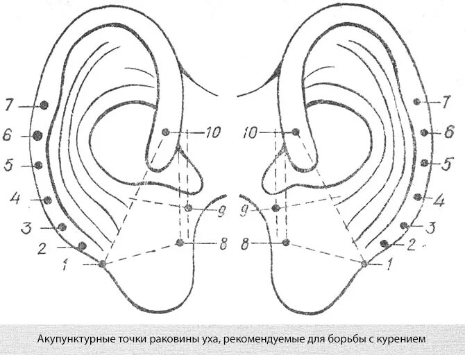 Точки шум в ушах. Акупунктурные точки от курения метод Бурдиоля. Схема точек на ушной раковине. Точки акупунктуры на ушной раковине. Акупунктурные точки при табакокурении.