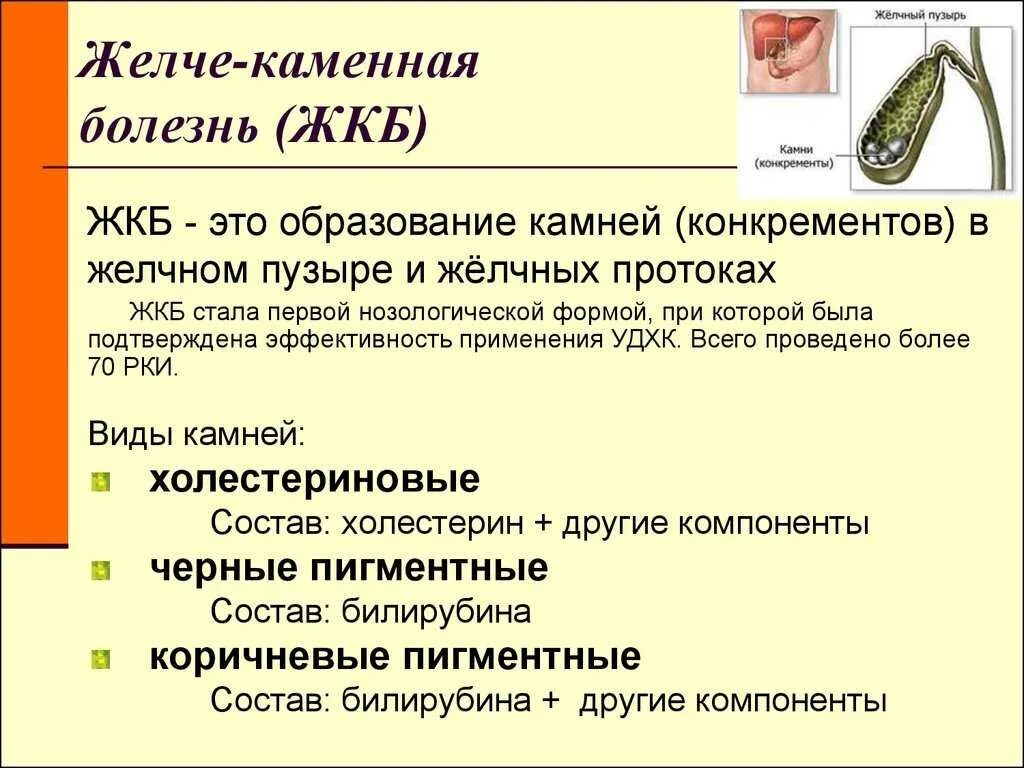 Что можно при обострении желчнокаменной болезни. Желчнокаменная болезнь. Диетаррижелчекаменойболезни. Диетотерапия при желчекаменной болезни. Дикта при желчекаменной болезни.