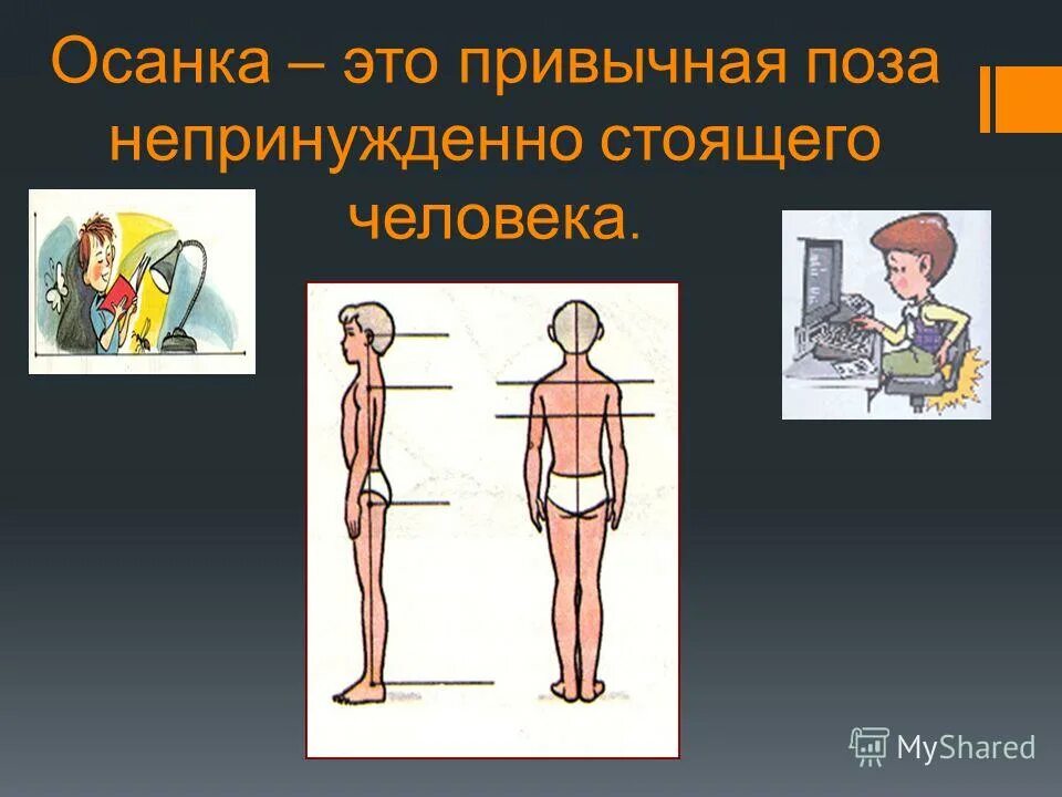 Как называется привычная поза непринужденно стоящего человека. Нормальная осанка человека. Привычное непринужденное положение тела человека. Привычная поза стоящего человека без мышечного напряжения. Привычное положение тела непринужденно стоящего.