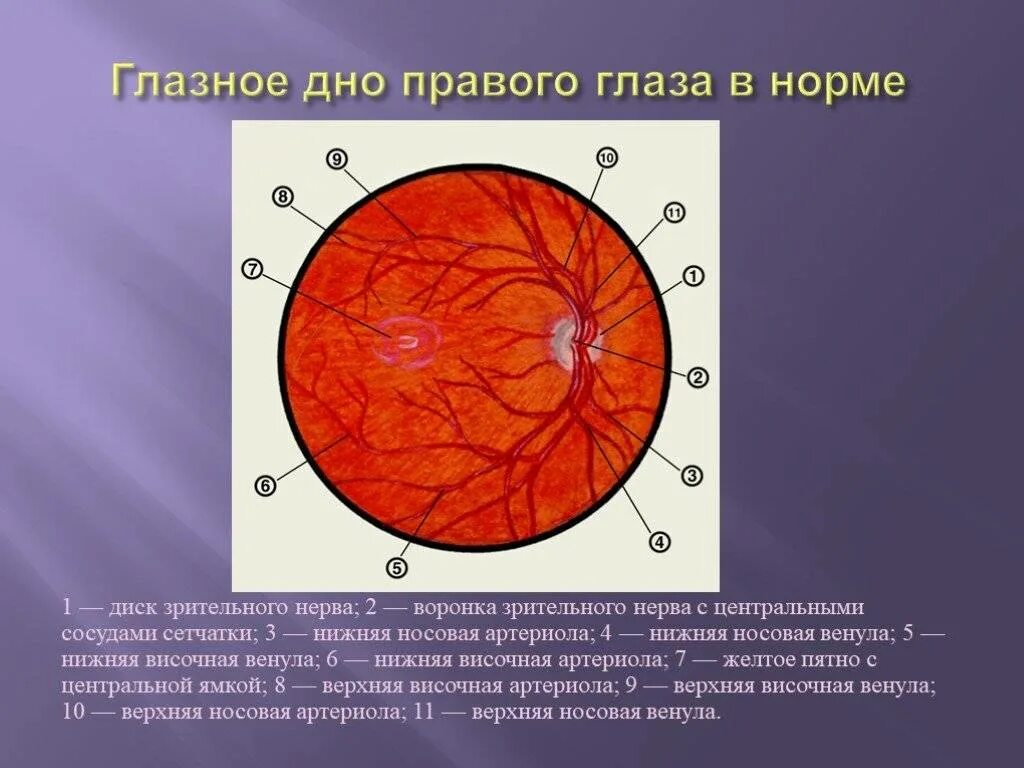 Офтальмоскопия глазного дна норма. Офтальмоскопия диска зрительного нерва. Офтальмоскопия глазного дна описание. ДЗН сосуды офтальмоскопия.