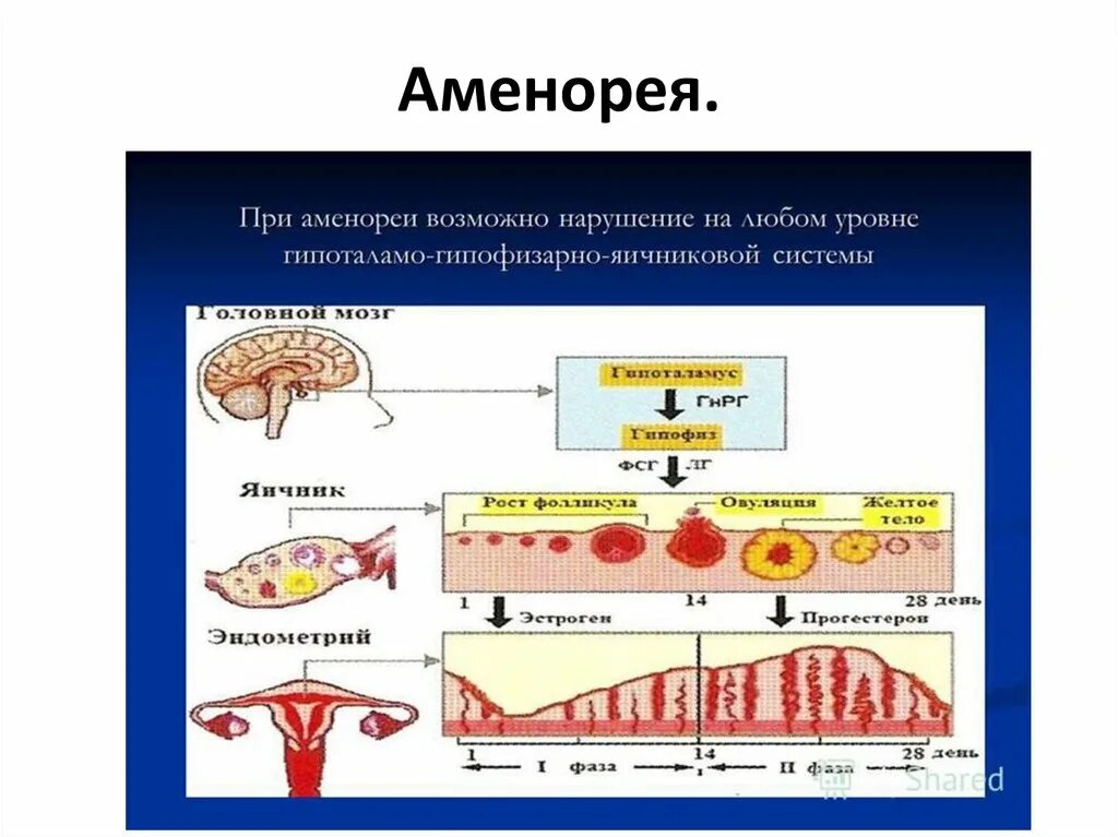 Во время процесса возможны. Аменорея. Истинная патологическая аменорея. Уровни регуляции менструального цикла таблица. Первичная аменорея классификация.