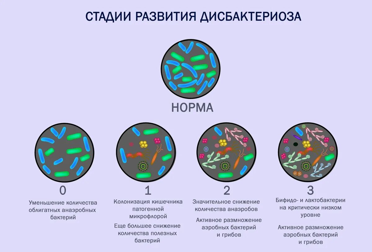 Расстройство микрофлоры. Дисбактериоз проявления микробиология. клинические проявления кишечного дисбактериоза. причины развития дисбактериоза. дисбактериоз микрофлоры кишечника.