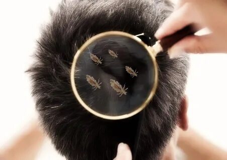 Педикулез что