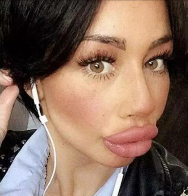Утиные губы