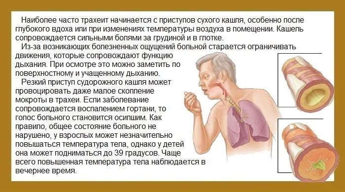 Утром появляется кашель. Кашель с мокротой болезни. Трахеит кашель у ребенка. Симптоматика при трахеите:. Качель с макрота сильный.