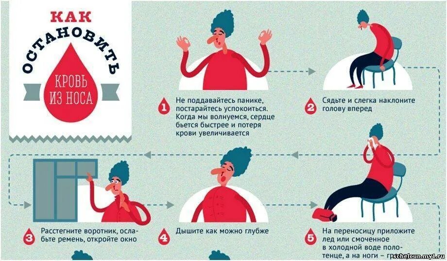 Остановить кровь из носа. Инфографика кровотечение. Как Остановить крововь из носа.