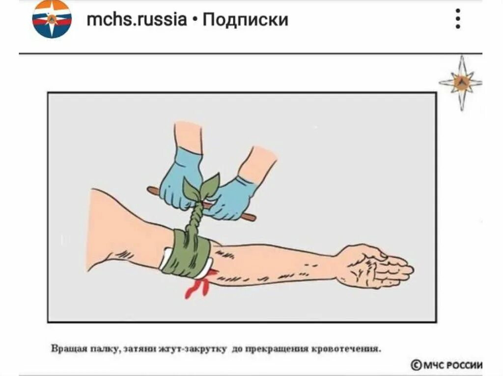 Холод при кровотечении. Артериальное кровотечение схема. рисунок на тему оказание первой помощи. памятка остановка кровотечения. первая помощь при наружном кровотечении.
