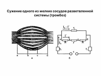 Сужение кровотока