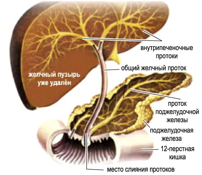 Механическая желтуха эрхпг. Человеческий желчный пузырь. Желчный пузырь вырабатывает желчь. Удалить желчный в спб. Лапароскопия желчного шрамы.