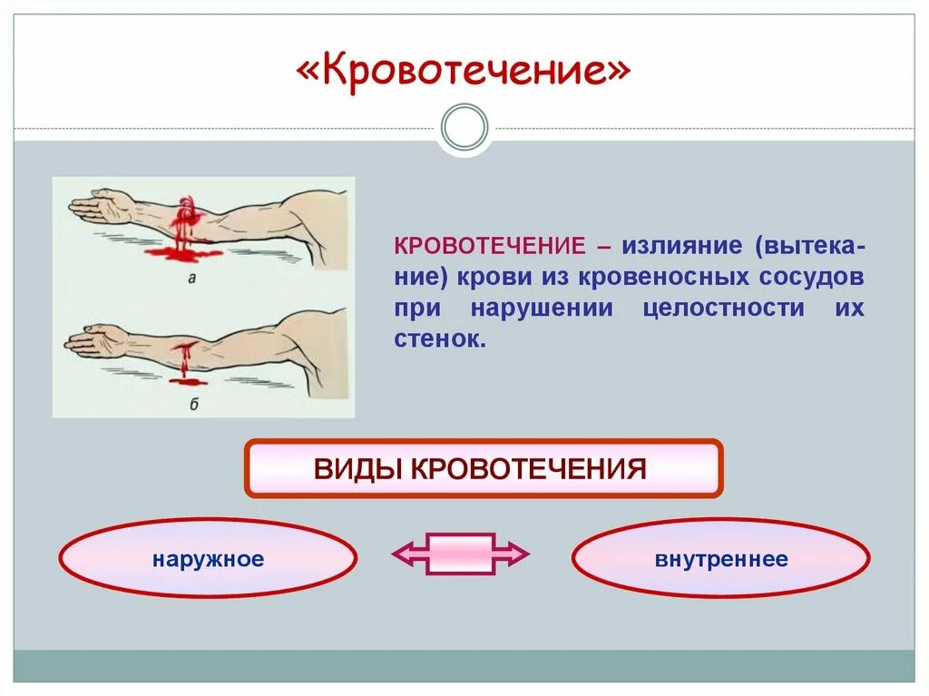 Какой сосуд поврежден. Виды кровотечений рисунок. Виды наружного кровотечения.