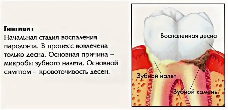 Зуб будто чешется