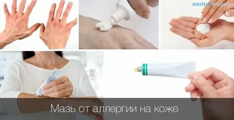 Чем лечить аллергию на солнце на руках