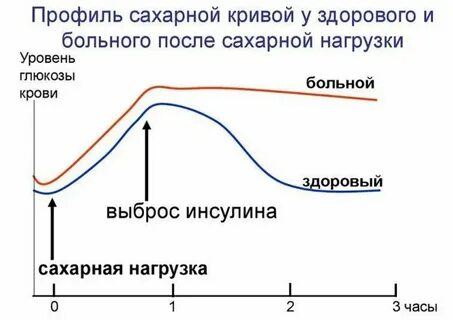 Сахарная кривая в норме