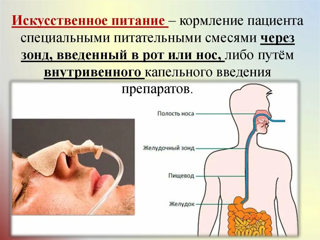 Выходит воздух из желудка через рот. Зонд для питания больных через нос. Кормление через желудочный зонд. Искусственное питание.