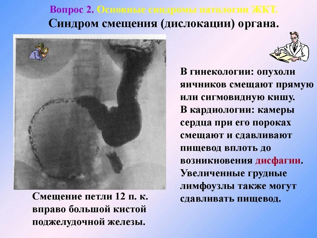 Вопросы по патологии. Основные синдромы патологии ЖКТ. Синдром дислокации органа ЖКТ. Дислокация желудка рентген.