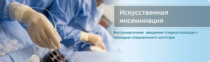 Осеменение женщины в клинике. Эко гинекология. Инсеминация. Инсеминация. Инсеминация клиники.