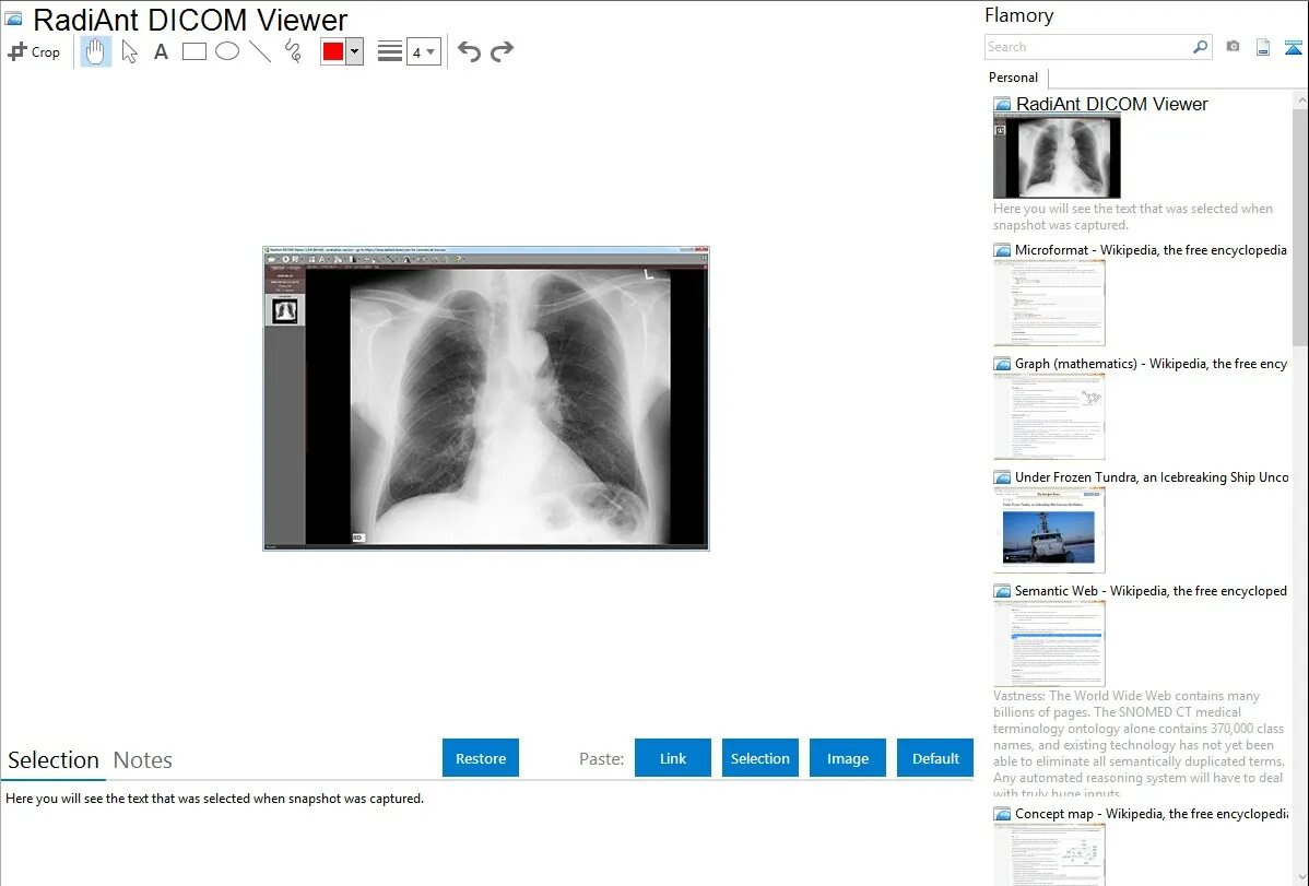 Microdicom viewer. Pacs dicom viewer это. radiant dicom viewer. dicom формат. радиант программа для рентгенолога.