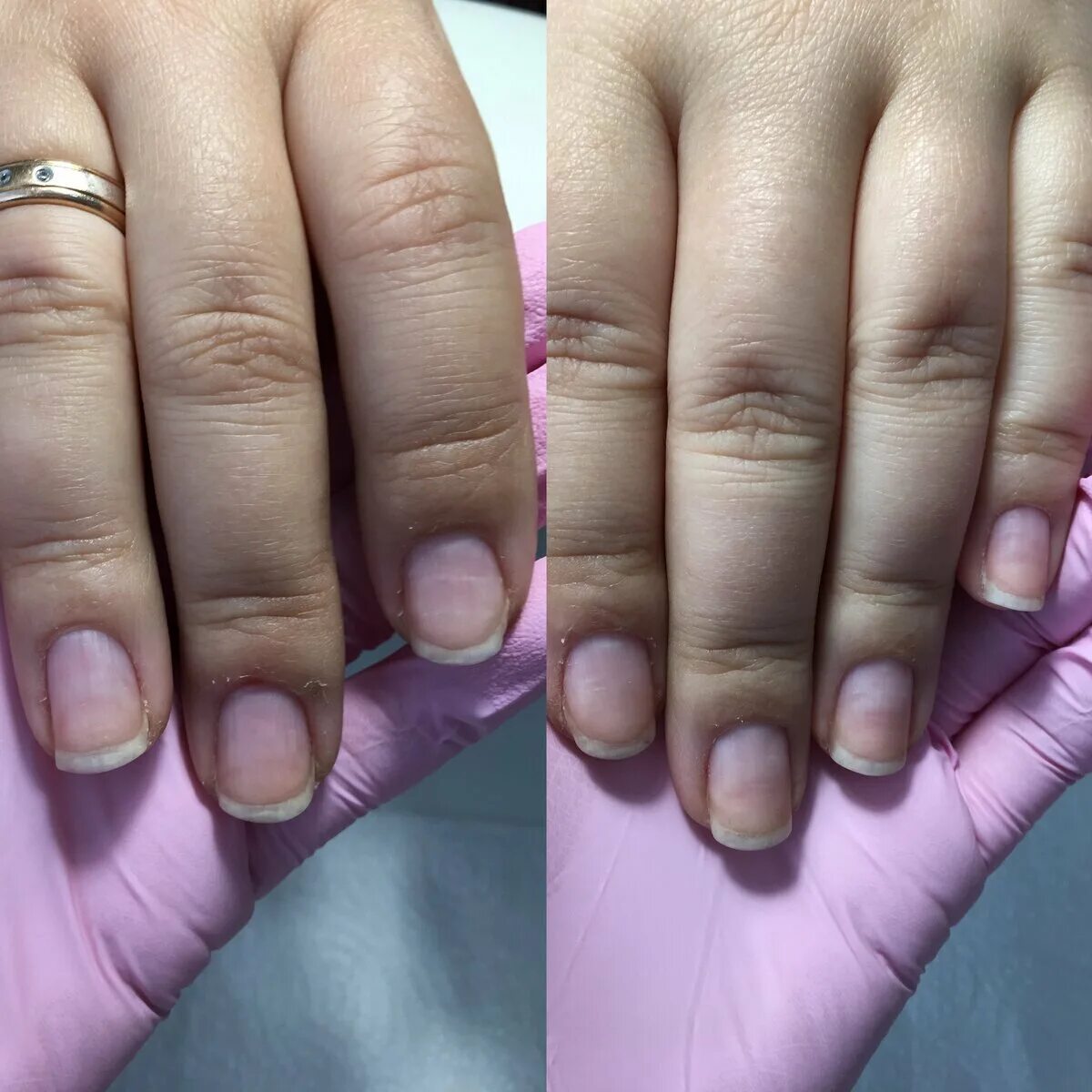 Мужской маникюр до и после. Широкие ногти. Маникюр на короткие широкие ногти. Маникюр до и после фото. Наращивание без лака