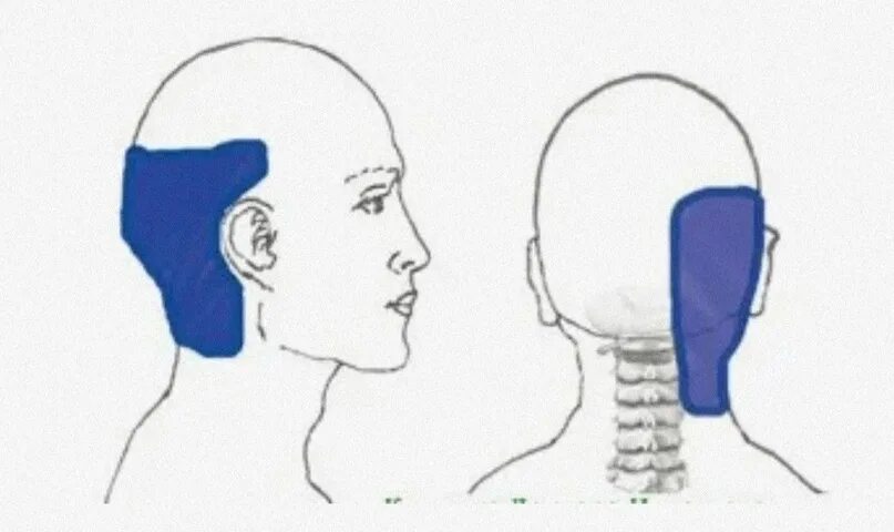 Голова левая сторона затылок. Головная боль в задней части. Болит затылок головы с правой стороны. Болит голова в затылочной части справа.