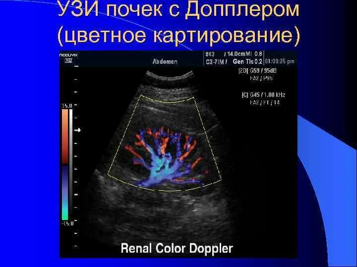 Строение почек УЗИ анатомия. УЗИ почек допплер сосудов почек. Ультразвуковая анатомия почки. Структура почки на УЗИ. Узи почек на голодный