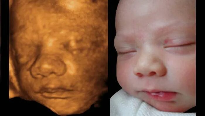 Cool or scary? This video of an unborn baby is fascinating - Today's Parent Preg