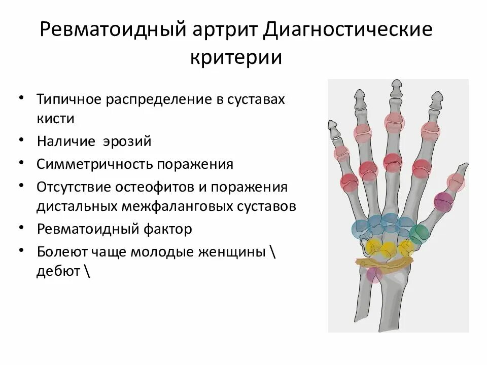 Ревматоидный артрит симметричность поражения. Дебют ревматоидного артрита симптомы. Диагностические признаки ревматоидного артрита. Ревматоидный артрит диа. Ревматоидный маркер