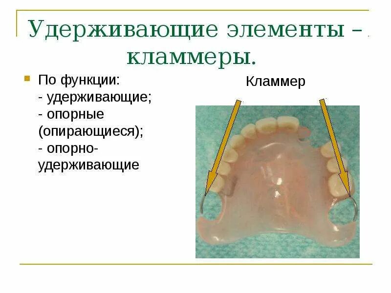 Удерживающий элемент. Опорно удерживающие кламмера. изготовление кламмера опороудерживающего. элементы опорно-удерживающего кламмера. литой кламмер опорно удерживающий.