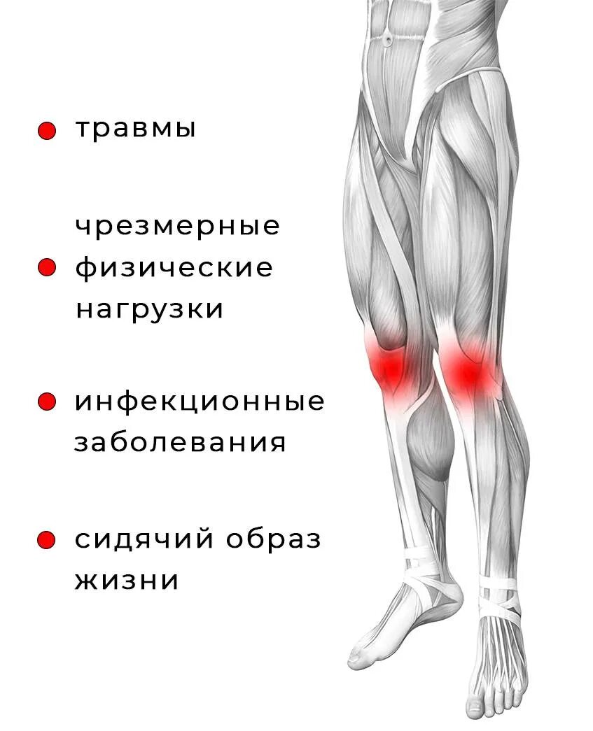 Сильные боли бедра причины