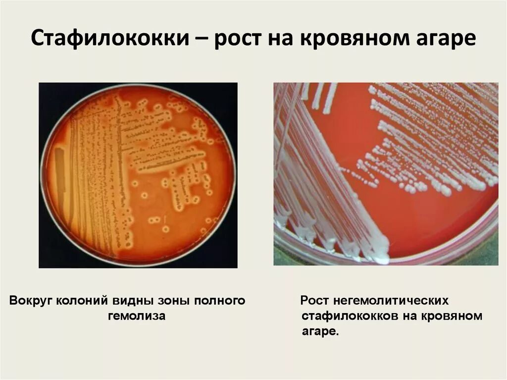 Стафилококки описание