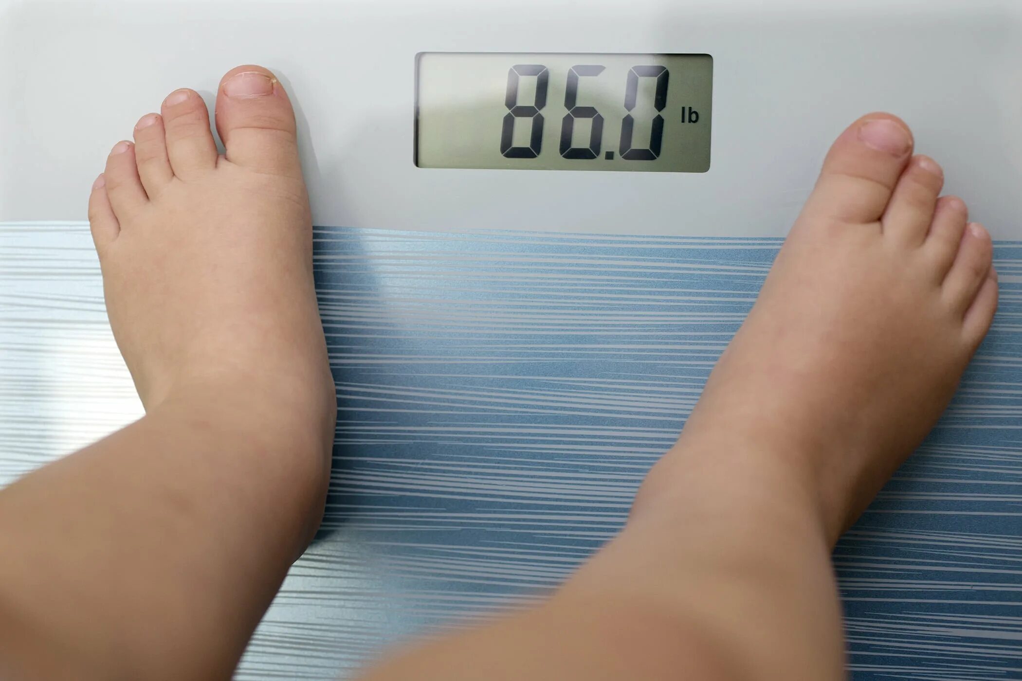 Ожирение 11 лет. Лишний вес у детей. Лишний вес у подростков. Избыточный вес у детей. Лишний вес у подростка.