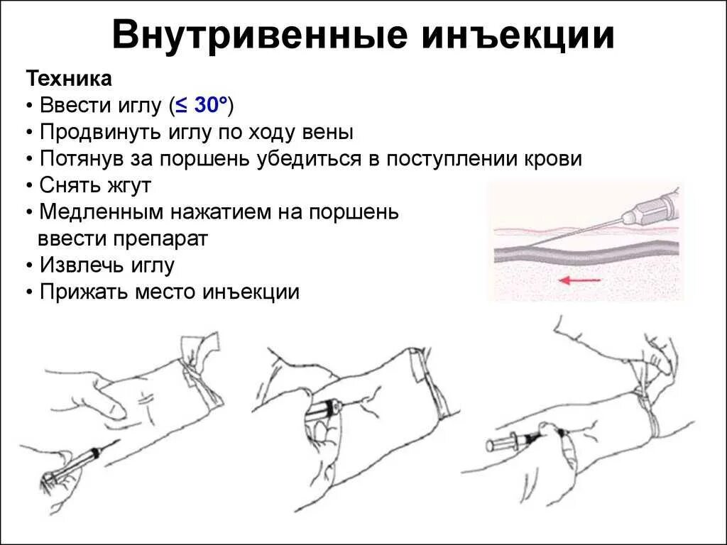 Для чего назначают горячие уколы в вену. При выполнении внутривенной инъекции, игла вводится:. Алгоритм ввода инъекции внутривенно. Внутривенная инъекция глубина введения иглы. Алгоритм внутривенного введения лекарственных.