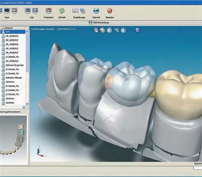Cad cam это. Фрезерование коронок cad cam. camcad моделирование протезов. кад кам технологии в стоматологии.
