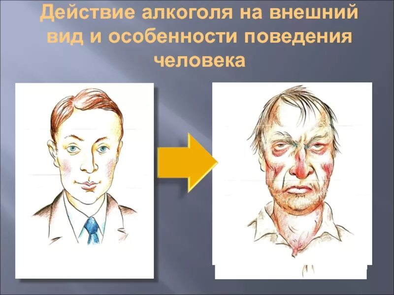 Как понять пьющего человека. Проявление алкоголизма на лице. Симптомы алкоголизма на лице.