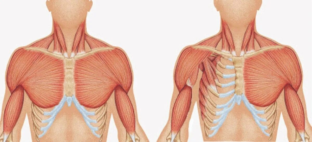 Синдром лестничной мышцы симптомы. Большая и малая грудные мышцы. Плечелопаточный периартроз патогенез. Большая грудная мышца начало и прикрепление. Синдром грудной мышцы.
