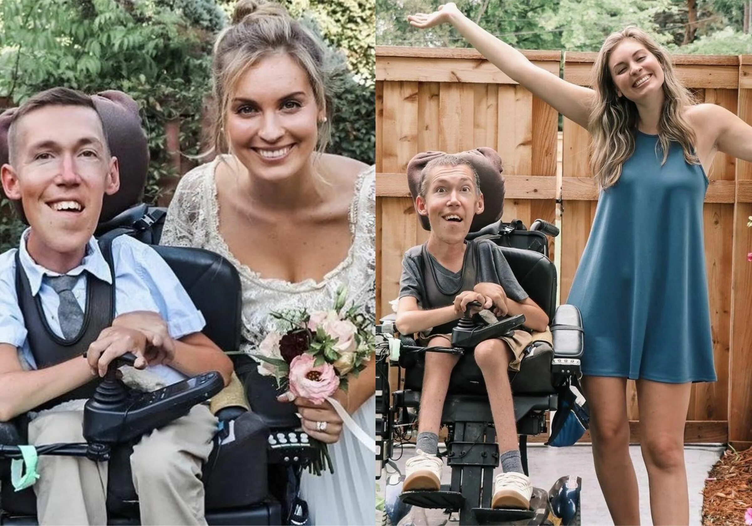 Свадьба инвалидов. Григорий прутов белгород. Вышла замуж за инвалида. Красивые девушки инвалиды. Григорий прутов инвалид.