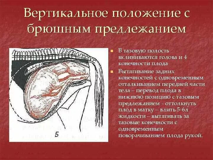 Положение со. Положение со