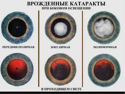 Глаза морфологический