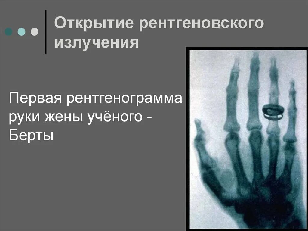 антикатод рентгеновской трубки. 1895 рентгеновское излучение вильгельм рентген. рисунок рентгеновского излучения. рентгеновская трубка физика. рентгеновские лучки откроыа.