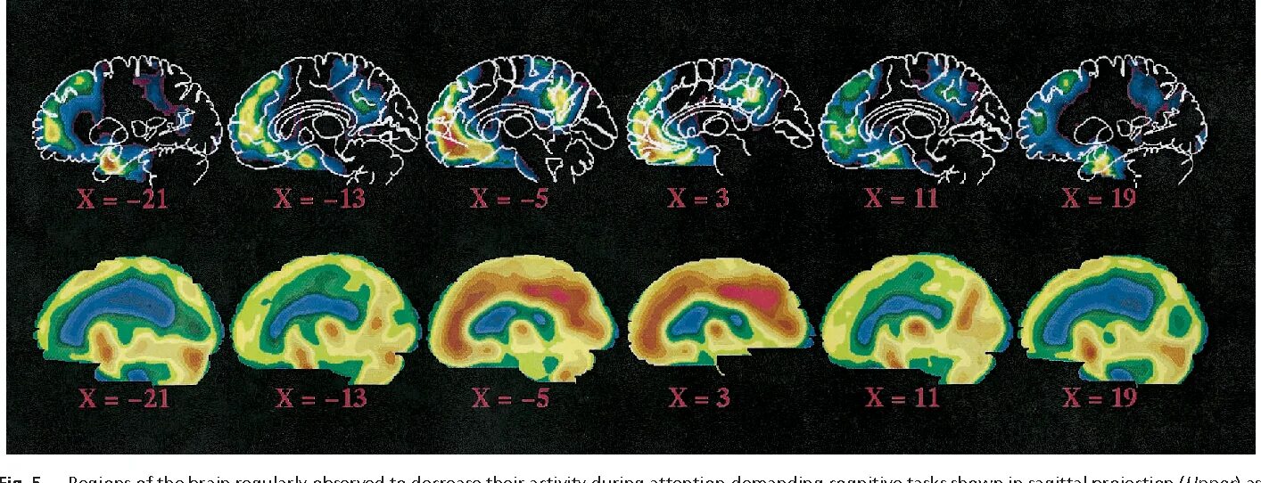 Дефолт система. Дефолт система. Люди в дефолт системе мозга. Дефолт-система мозга» (дсм). Дсм система мозга.