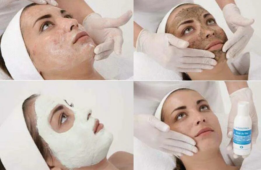 Пилинг роз. Коралловый пилинг роз де мер. Коралловый пилинг роз де мер. Пилинг роз де мер до после. После кораллового пилинга.