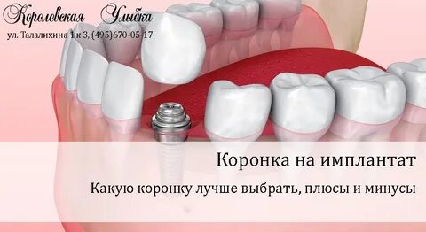 Коронка срок гарантии