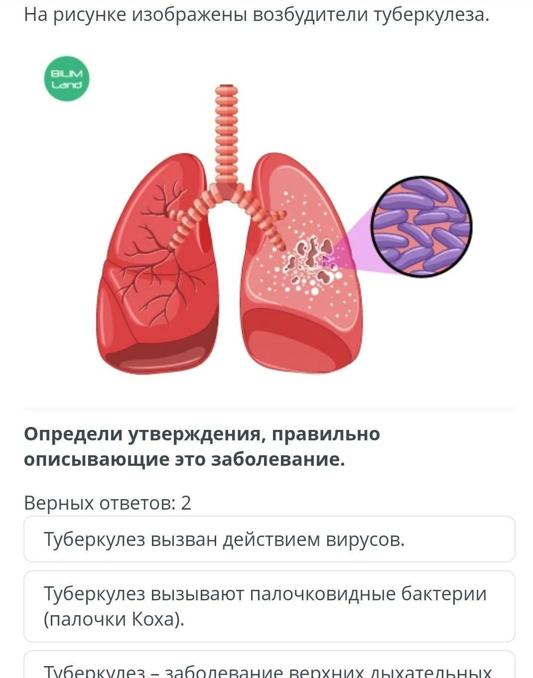 Заболевание туберкулез вызывают бактерии. Бактерия вызывающая туберкулёз. Туберкулез вызывается. Палочка Коха туберкулез.