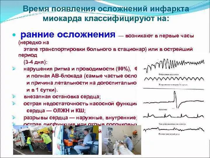 Самое частое осложнение инфаркта миокарда в первые часы. Ранние осложнения инфаркта миокарда. Транспортировка с неосложненным инфарктом миокарда осуществляется. У больного с инфарктом миокарда в первые часы чаще всего развивается. Частые осложнения инфаркта миокарда